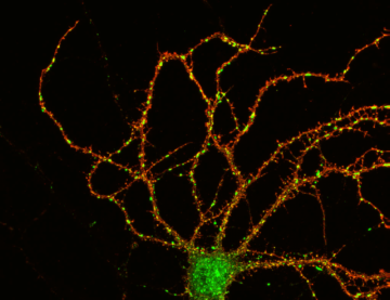 « Advanced Imaging Methods for Cellular Neuroscience »