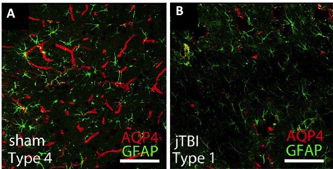 AQP4 (red) labeling is visible around blood vessels (A) and significantly decrease expression in jTBI at 2 months after the injury (Fukuda et al., Neuroscience 2012)