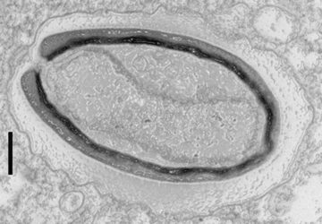 Les Pandoravirus questionnent l’origine de la vie