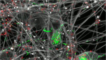 Des réseaux de neurones humains pour modéliser la maladie de Parkinson