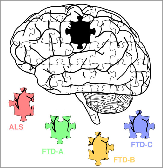 Dans la maladie de Charcot (amyotrophic lateral sclerosis, ALS) ou plusieurs types de maladie de Pick (frontotemporal dementia, FTD), des assemblages pathologiques de protéines distincts ont été identifiés, ayant des propriétés neurotoxiques différentes. Ces pièces manquaient au puzzle…