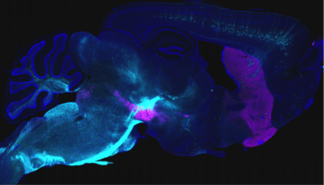 Cajal course: « Biosensors and actuators for cellular and systems neuroscience »