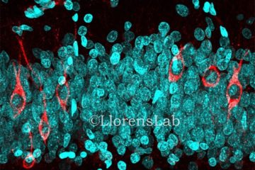 Newborn neurons (DCX+, in red) and DAPI in the human DG - Credit : LLorens Lab