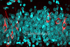 Newborn neurons (DCX+, in red) and DAPI in the human DG - Credit : LLorens Lab