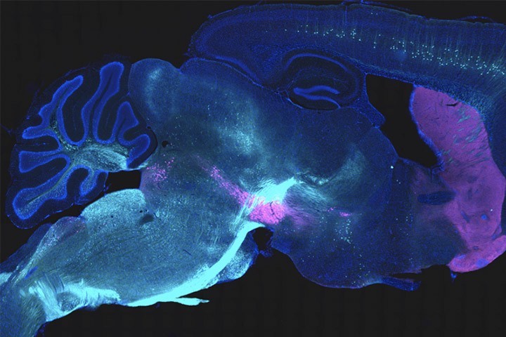 Cajal Course talks : Biosensors and actuators for cellular and systems neuroscience