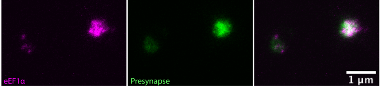 Identification de la protéine eEF1α aux presynapses excitatrices purifiées.