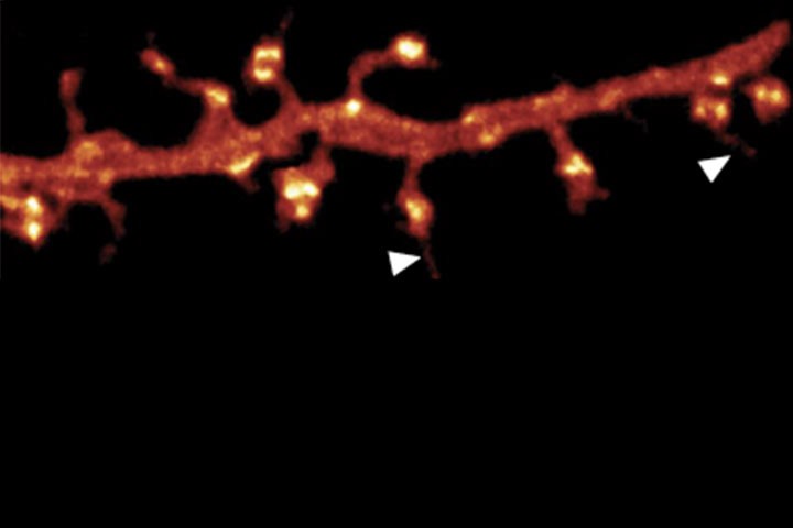 V. Nägerl, J.B. Sibarita et al dans Nature Methods