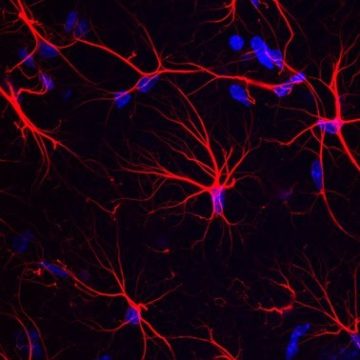 Astrocytes dans l’hippocampe du cerveau de souris © Laboratoire des maladies neurodégénératives (CNRS/CEA/Université Paris Saclay)