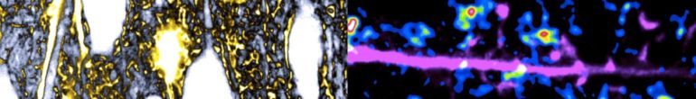 Figure: STED imaging reveals astrocytic processes infiltrating neuropil (left) and exhibiting local Ca2+ signals at individual synapses (right).