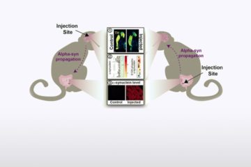 ML Arotcarena et al in Brain