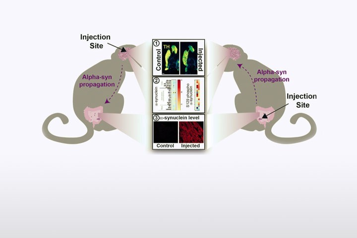 ML Arotcarena et al dans Brain