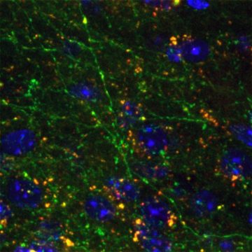 Axons (green) and synapses (red) of glutamatergic neurons of the insular cortex expressing the serotonin 1A receptor. The image was taken in the mouse central amygdala with a Leica SP8 confocal microscope. Cell nuclei DNA is stained in blue. Credit: Anes Ju & Anna Beyeler