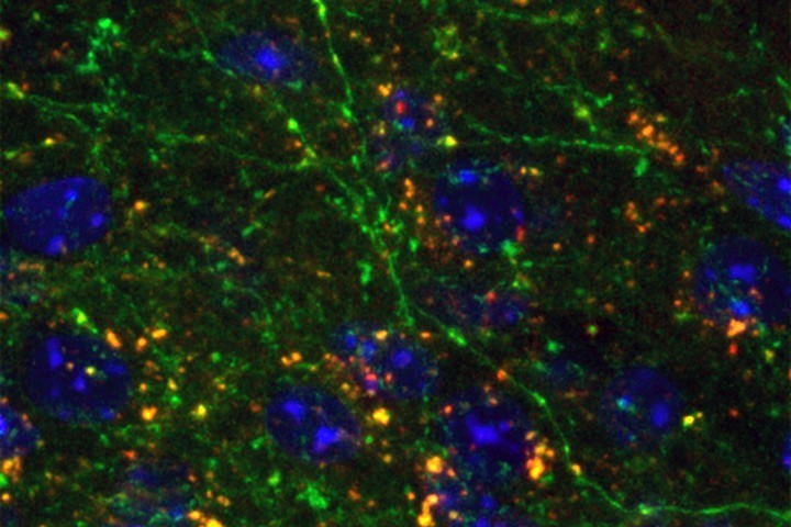 Anes Ju, Anna Beyeler et al in Mol Brain