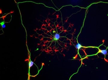 Dans une culture de neurones cohabitent des cellules nourricières, les astrocytes (cellule étoilée au centre en rouge). Marquage de la tubuline en vert, de l'actine en rouge, des noyaux en bleu. Les chercheurs se sont intéressés à ces cellules pour comprendre l’impact de la consommation de cannabis sur la sociabilité. Inserm/Saoudi, Yasmina/Ballet, Sandrine