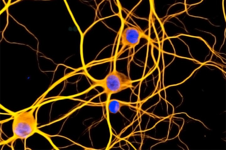 Network of hippocampal cultured neuron