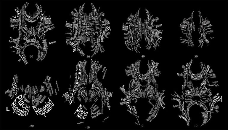 Coupes axiales de l’Atlas fonctionnel de la substance blanche cérébrale humaine. Crédit : Michel Thiebaut de Schotten