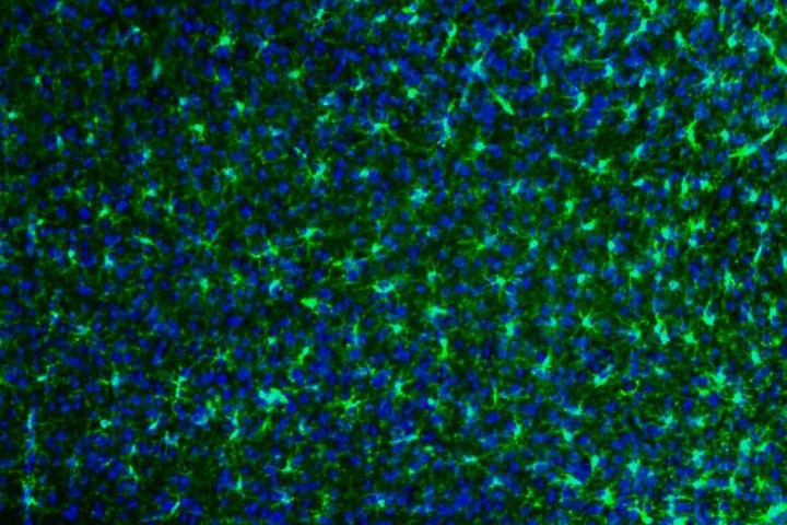 Cellules microgliales (en vert) et noyaux des cellules microgliales et autres cellules dont les neurones (en bleu) © INRAE