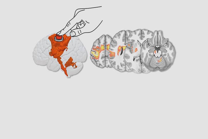 V.Nozais, S. Forkel, L. Petit & M. Thiebaut de Schotten dans Nature Communications Biology