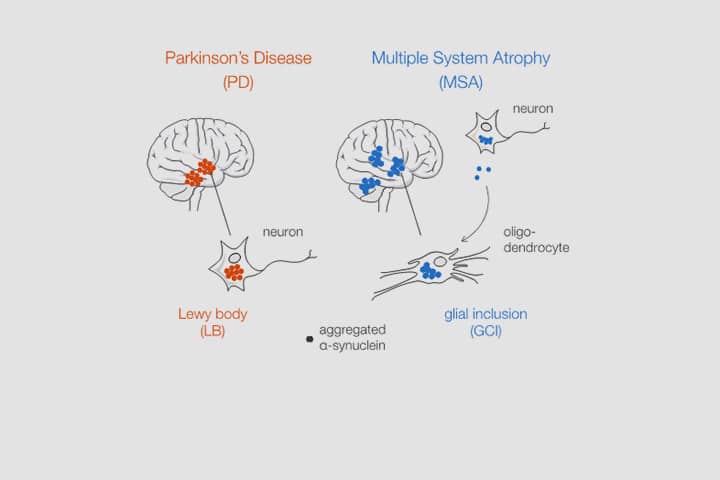 Florent Laferrière, Erwan Bezard, Francesca De Giorgi, François Ichas et al. dans npj Parkinson’s disease