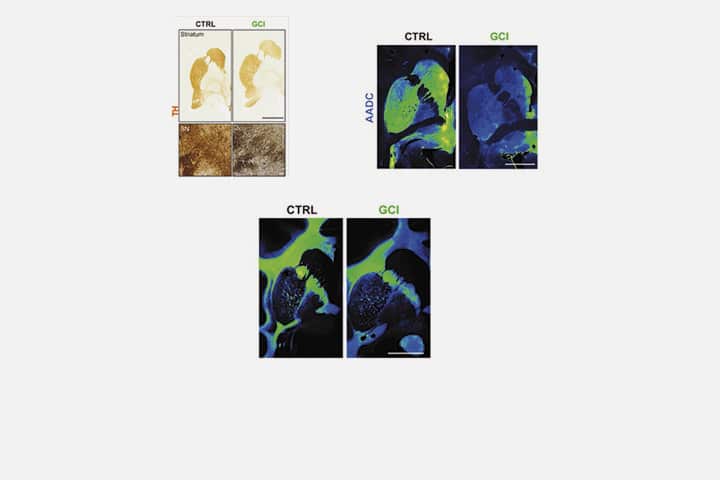 M. Teil, S. Dovero S, M. Bourdenx, ML Arotcarena et al dans Brain