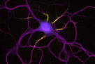 La protéine Prickle2, déterminant de la polarité neuronale et nouveau composant du segment initial axonal