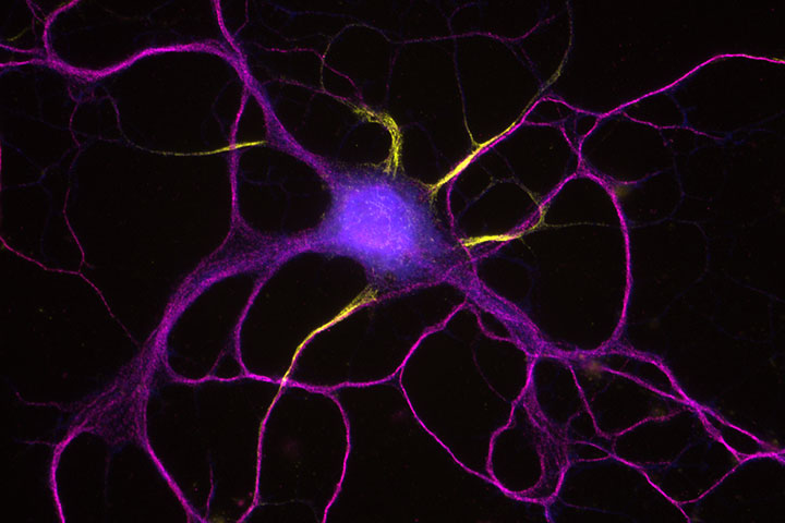 Prickle2 is a neuronal polarity determinant and a new component of the AIS