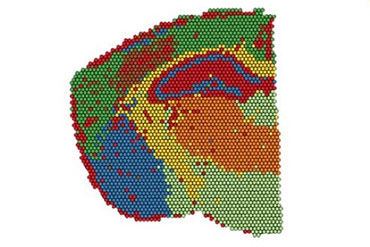 Mise en place de la Spatial Transcriptomic