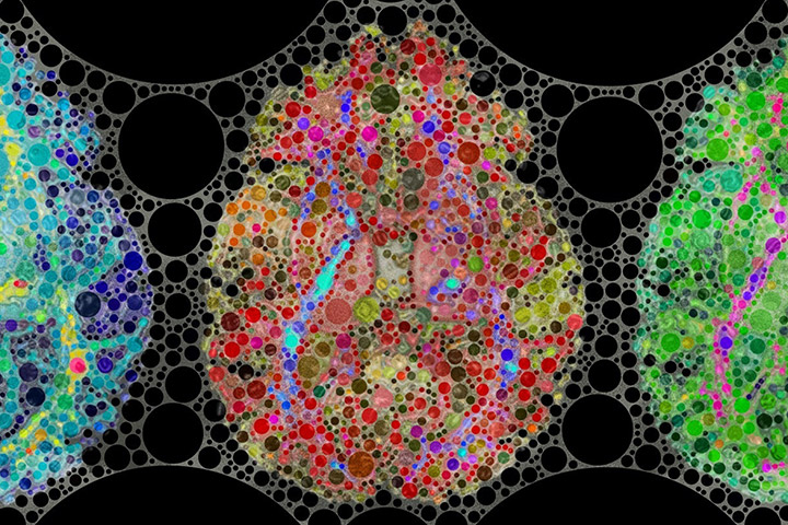 Brainconf NeuroCompare