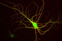 Live extracellular labeling of neosynthesized GluA1 90 minutes after release from the endoplasmic reticulum. Green: GluA1 in the endoplasmic reticulum, Red: externalized GluA1