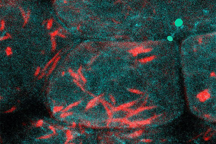 Expansion Microscopy workshop