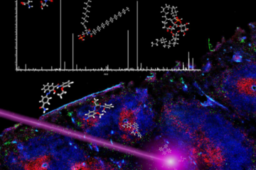 Atelier « Initiation à l’Imagerie par Spectrométrie de Masse MALDI Appliquée à la Santé »