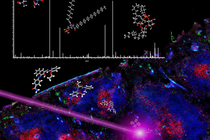 Atelier ＂Initiation à l’Imagerie par Spectrométrie de Masse MALDI Appliquée à la Santé＂