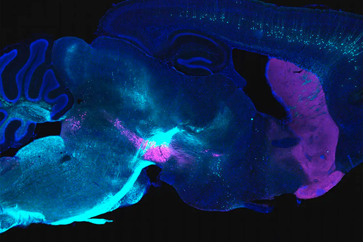 Cajal lectures: Optogenetics, chemogenetics and biosensors for cellular and circuit neuroscience