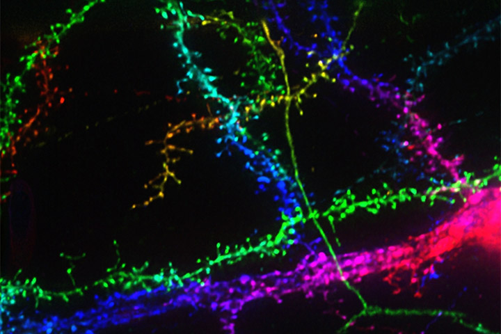 Mini Symposium on Light-sheet Microscopy Developments and their Applications to Neuroscience