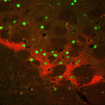 Immunofluorescence illustrating neuronal activity in striosome and matrix compartments in the dorsal striatum.