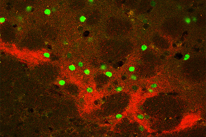 Immunofluorescence illustrating neuronal activity in striosome and matrix compartments in the dorsal striatum.