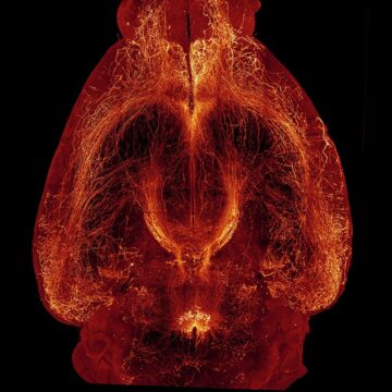 Visualisation des fibres nerveuses contenant de la relaxine-3 après transparisation du cerveau entier d'une souris.© Thibault Dhellemmes/Jérémie Teillon/Marc Landry/Bordeaux Imaging Center