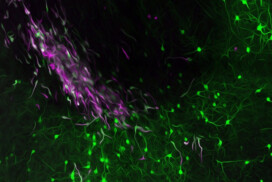 Cajal Course: Cancer Neuroscience