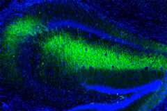 L’expression et l’activation de mitoDREADD-Gs (ici coloré en vert) dans l’hippocampe permet d’y augmenter l’activité mitochondriale et de restaurer la mémoire chez des modèles murins de démence. © Rui Rodrigues/Inserm
