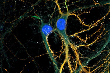 Sonia Poirault-Chassac sur le compte Instagram de l’Inserm