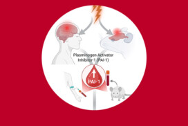 Stress-induced plasminogen activator inhibitor-1 (PAI-1) as a blood biomarker and brain risk factor for PTSD.