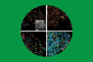 Team Giannone in Nature Cell Biology, highlighted in Science