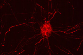 PLCG2 downregulation impairs synaptic function and increases Alzheimer’s disease hallmarks in neuronal cultures